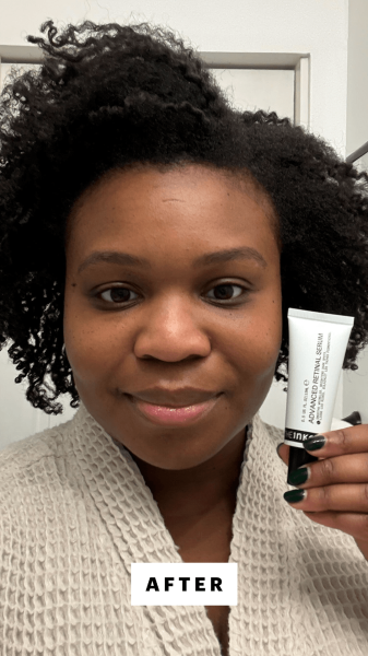 Cruel after applying the Inkey List Advanced 0.2 Retinal Serum